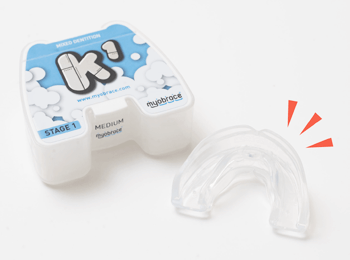 マイオブレース治療