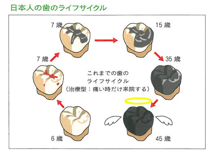 日本人の歯のライフサイクル